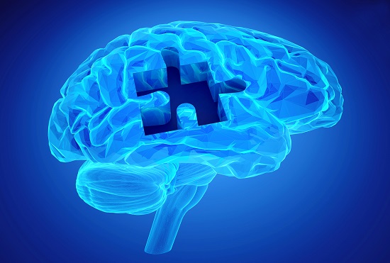 Dementia Disease And A Loss Of Brain Function And Memories